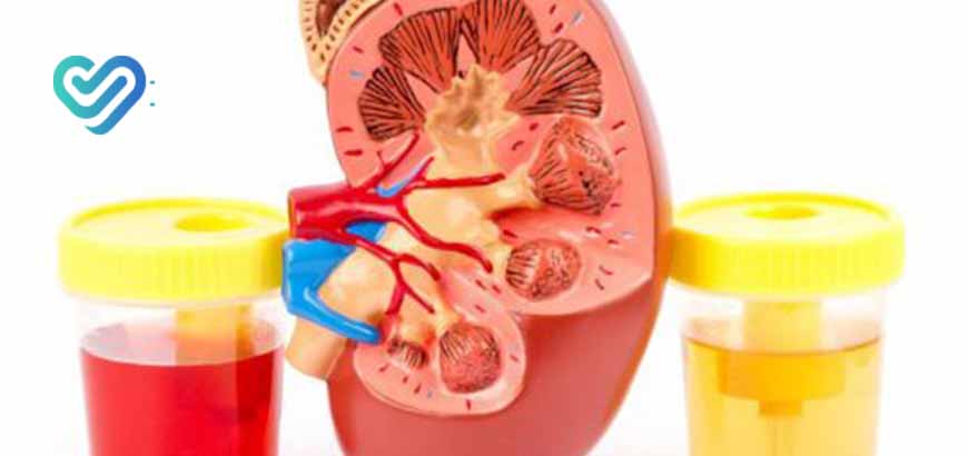 кровь в моче