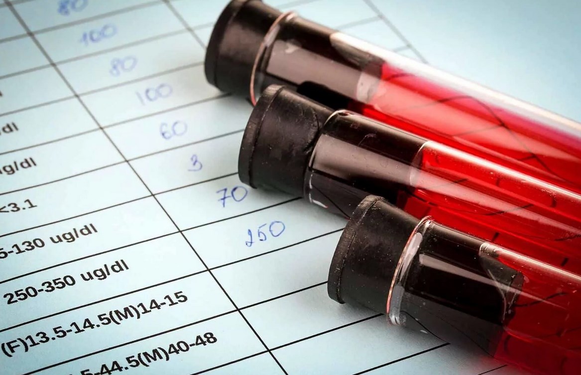 Высокий и низкий соэ и гемоглобин