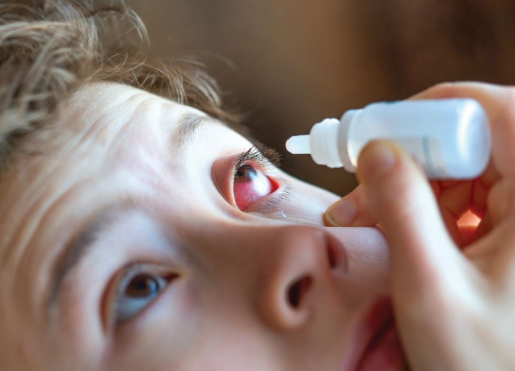 кровоизлияния в глазу