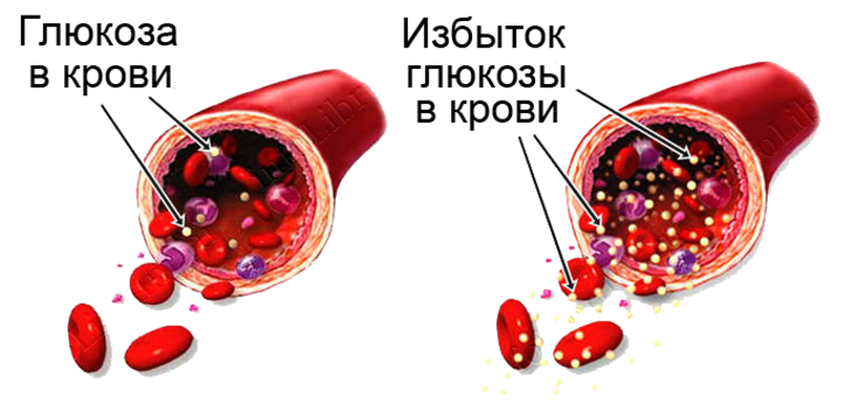 Глюкоза в крови