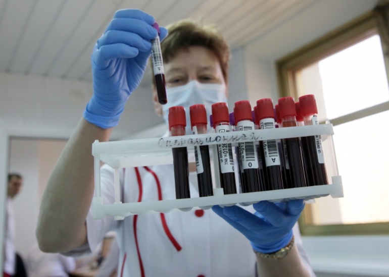 Голубая кровь выглядит как обычная,