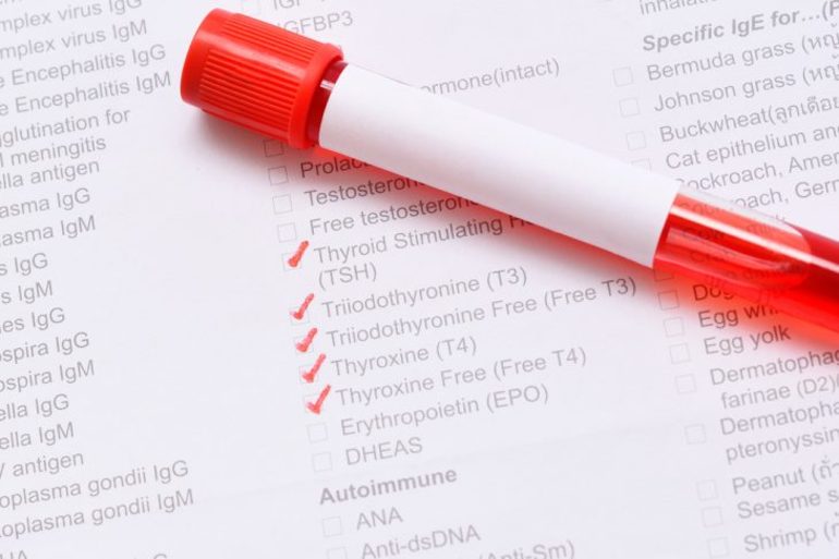 Гормоны щитовидки