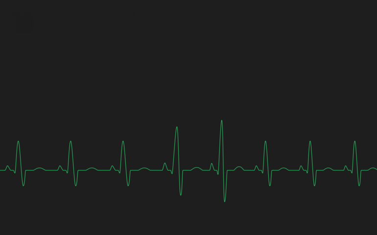 График работы сердечной мышцы