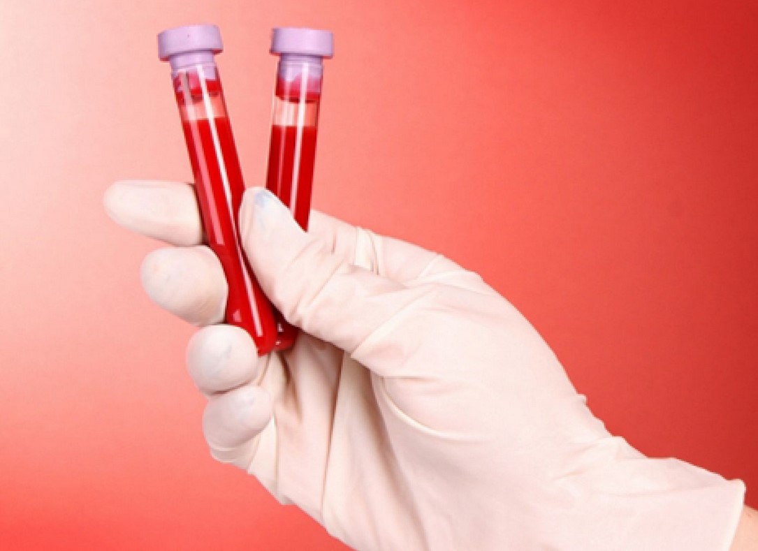 Группа крови