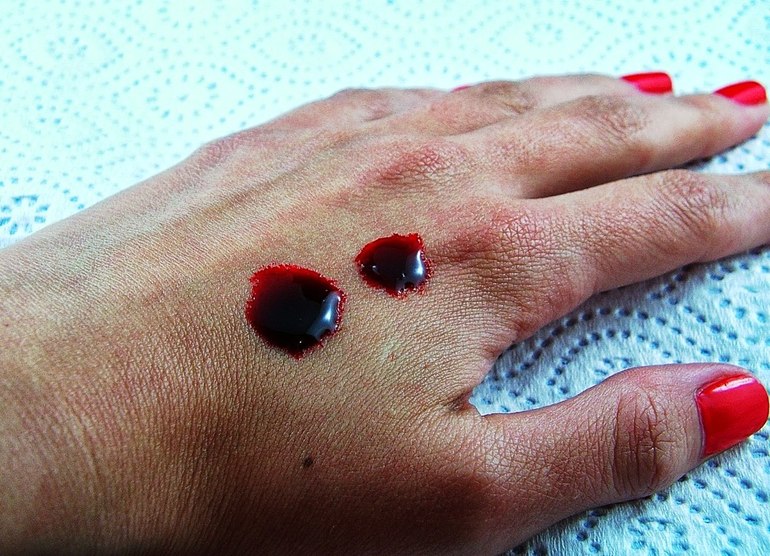 Густая кровь