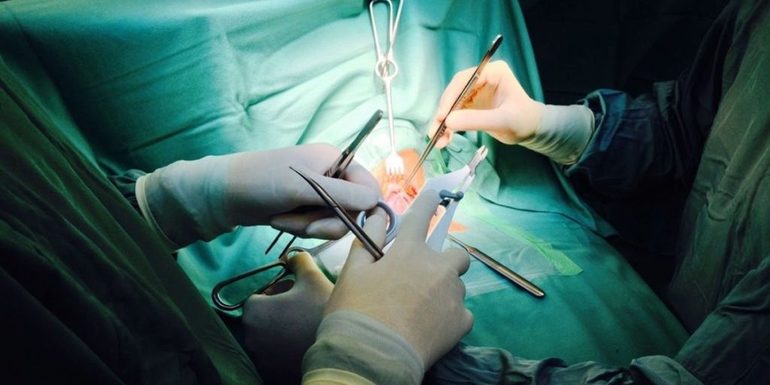 Хирургическое вмешательство, связанное с удалением щитовидки;