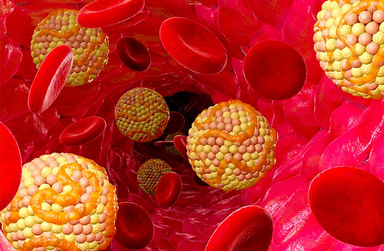 холестерин норма