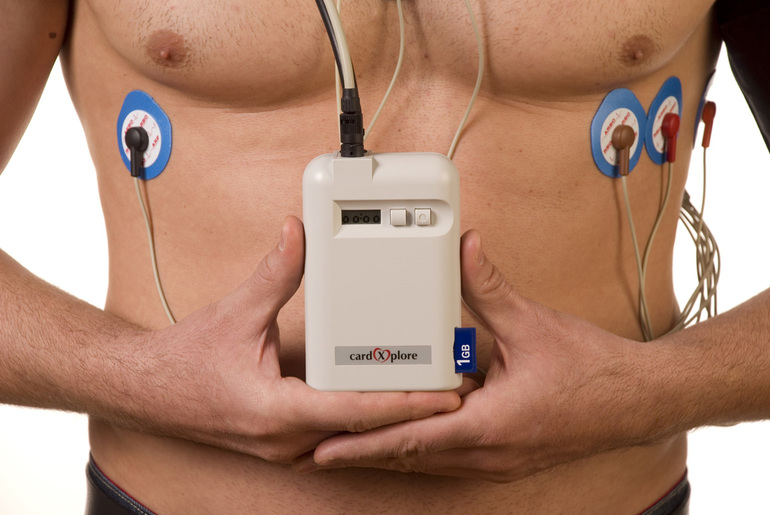 Холтеровское мониторирование ЭКГ