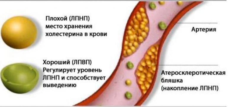 Хороший и плохой холестирин