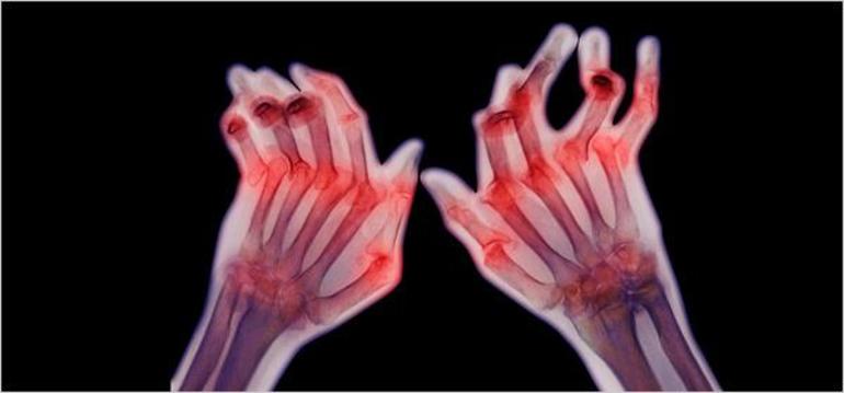 Иммуноферментный анализ