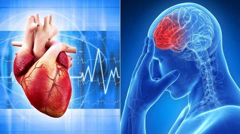 Инфаркт, инсульт,