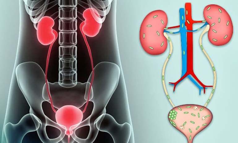 Инфекционные заболевания