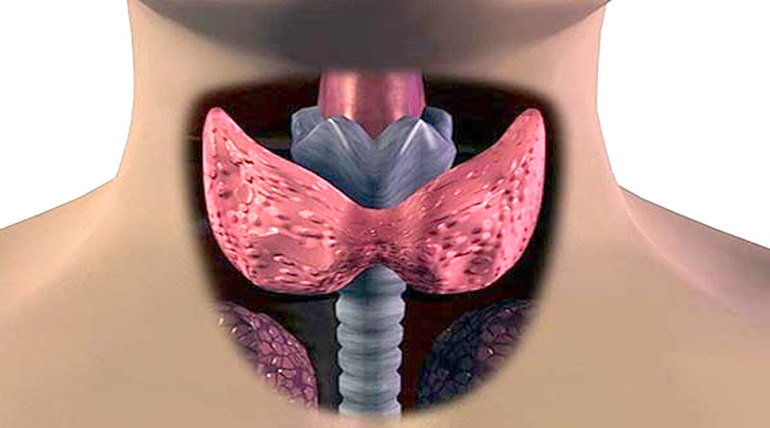 Иногда щитовидная железа выделяет слишком много тиреоидных гормонов.