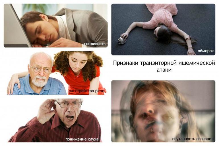 Ишемическая атака головного мозга симптомы