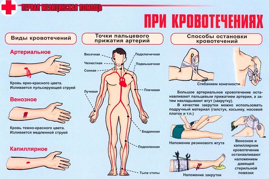 kak-okazat-pervuyu-pomosh