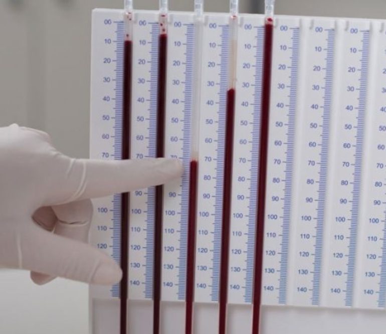 Какое соэ при раке