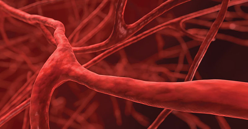 кальциноз сосудов