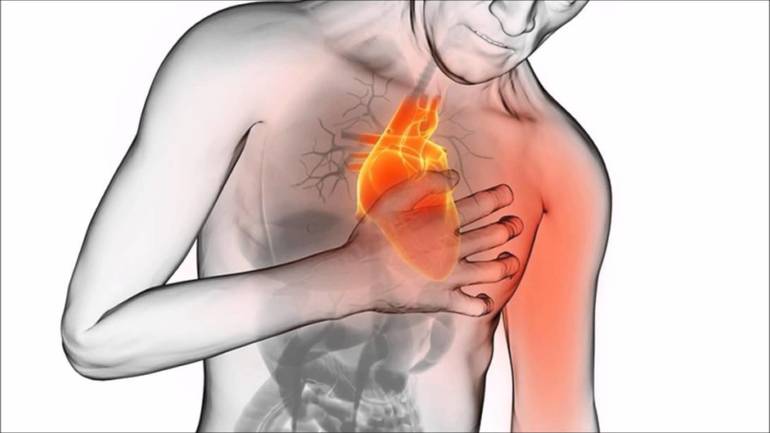 кардионевроз симптомы