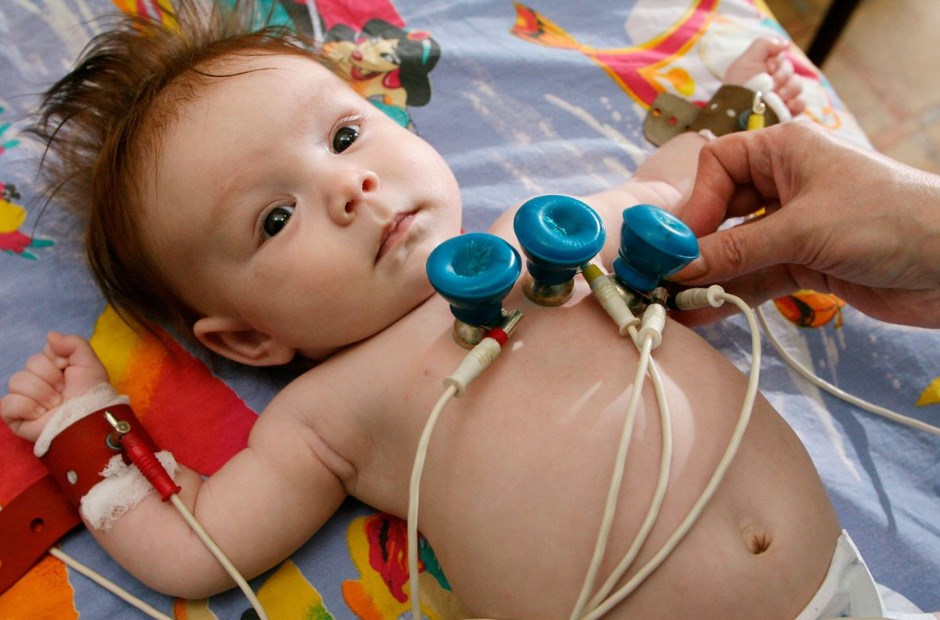 Электрокардиография