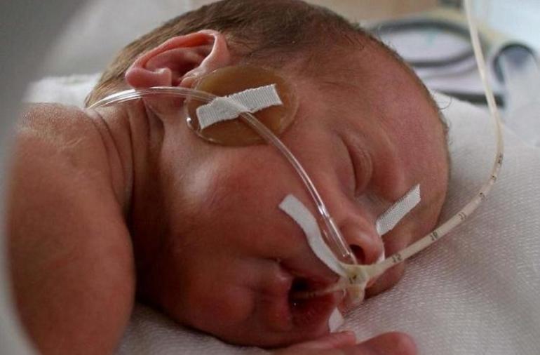 Кислородное голодание признаки