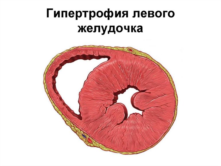 Клиническая картина заболевания