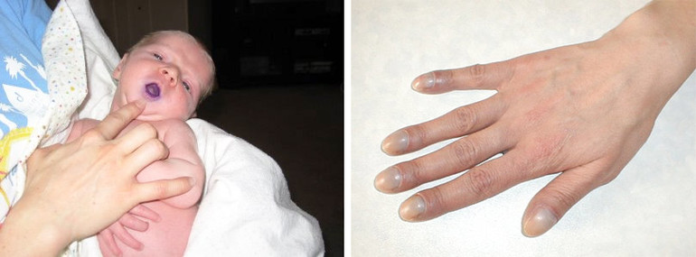 Комплексное обследование