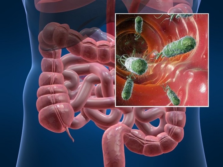 кровь в кале у женщины причины