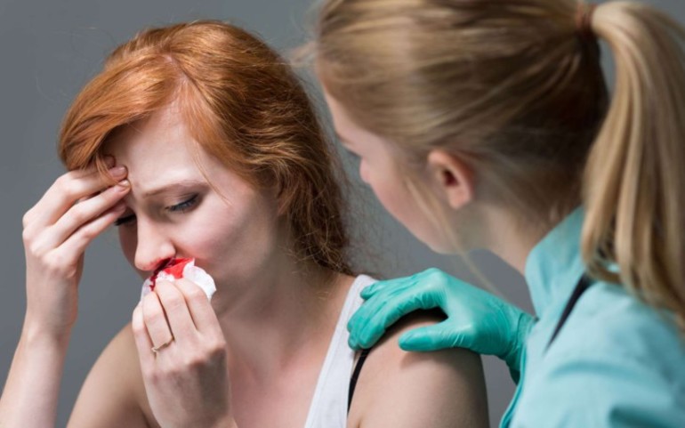 Кровь из носа у беременных