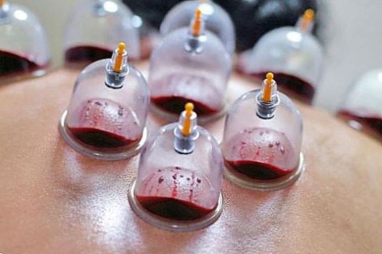 Кровоспускания польза для организма