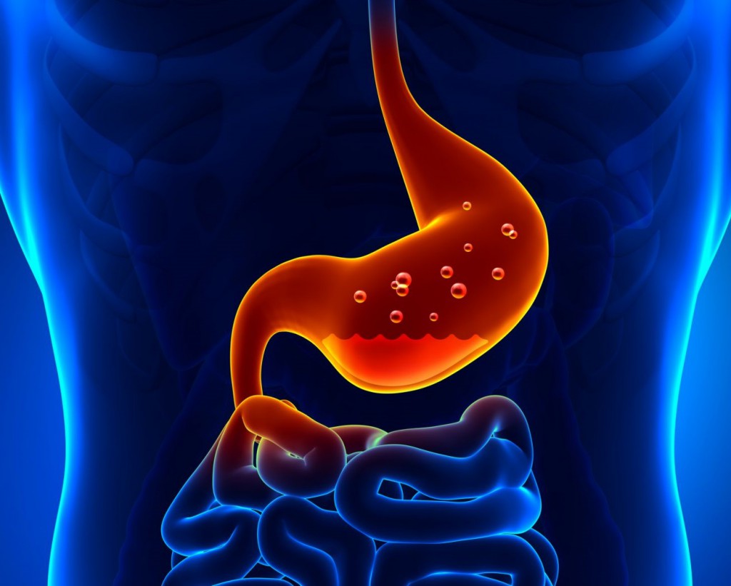 желудочное кровотечение