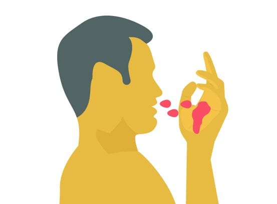 Кровотечение