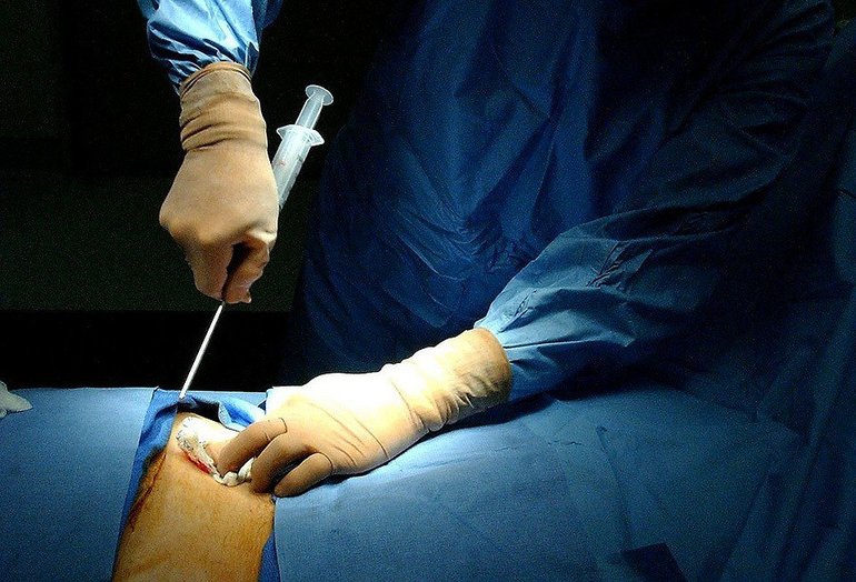 лечение рака крови