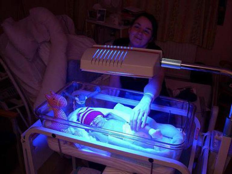 Лечение желтухи у нвоорожденных