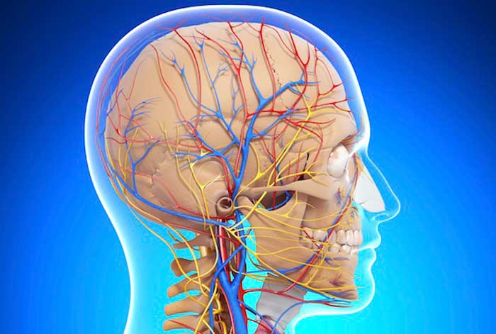 лейкоареоз головного мозга: