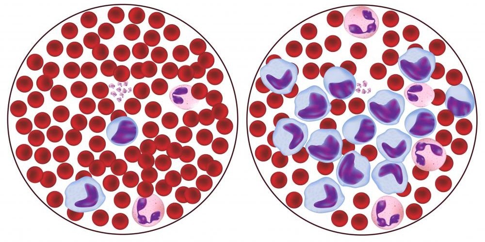 повышены лимфоциты