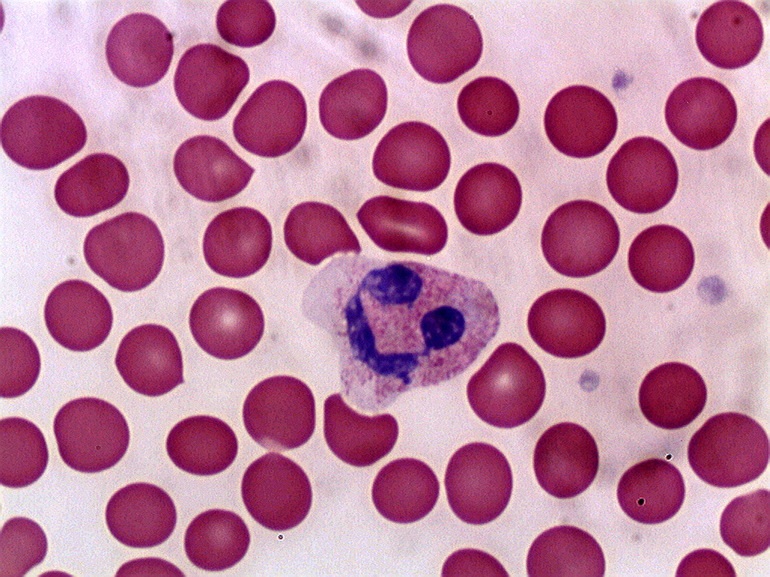 Макроцитоз эритроцитов