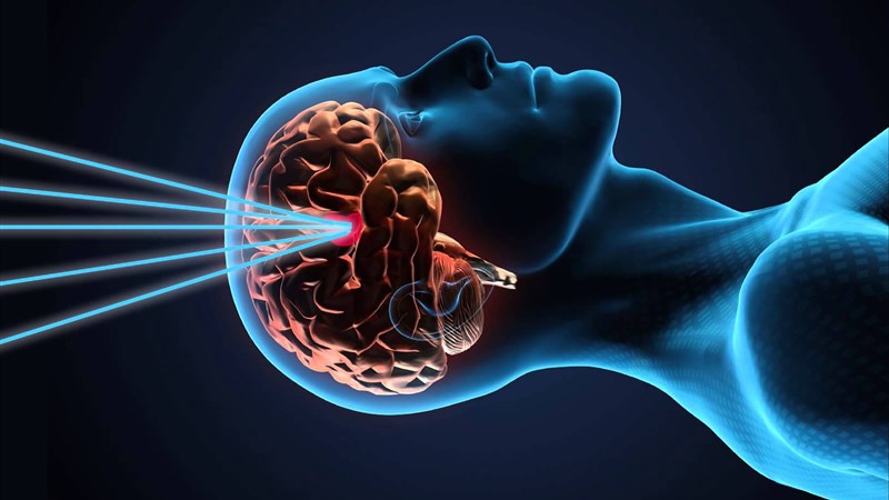 Мальформация сосудов головного мозга