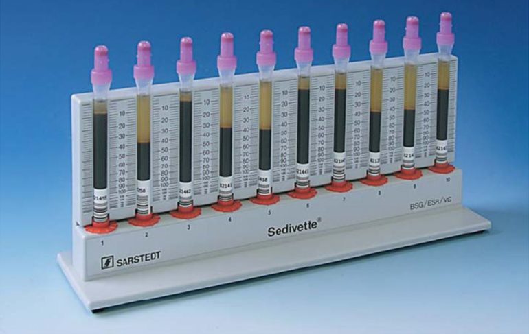Методика Панченкова