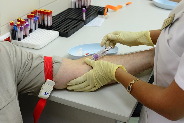 Методы анализов на HBsAg