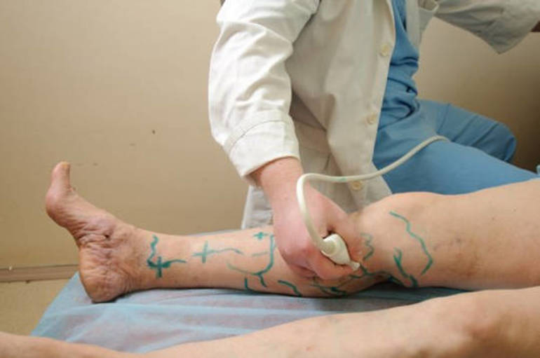 Методы диагностики тромбов