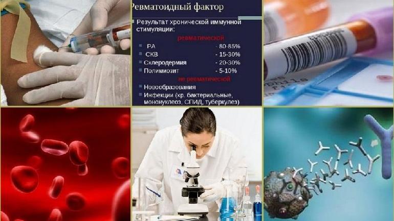 Методы исследования