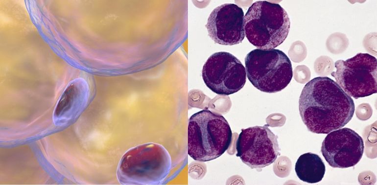 Миелобласты.