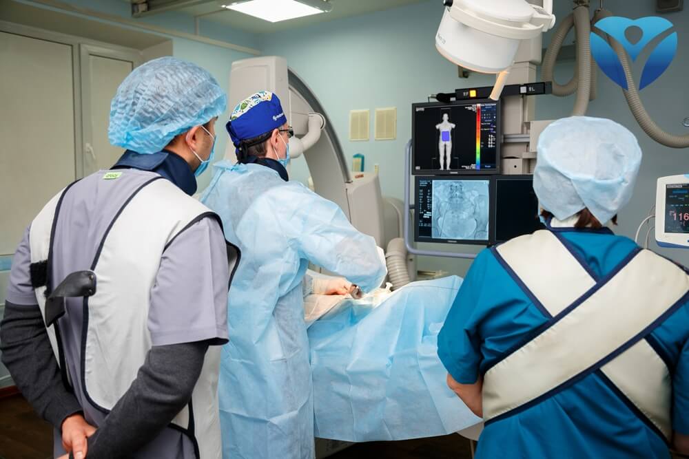 Эмболизация маточных артерий