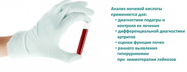 мочевая кислота