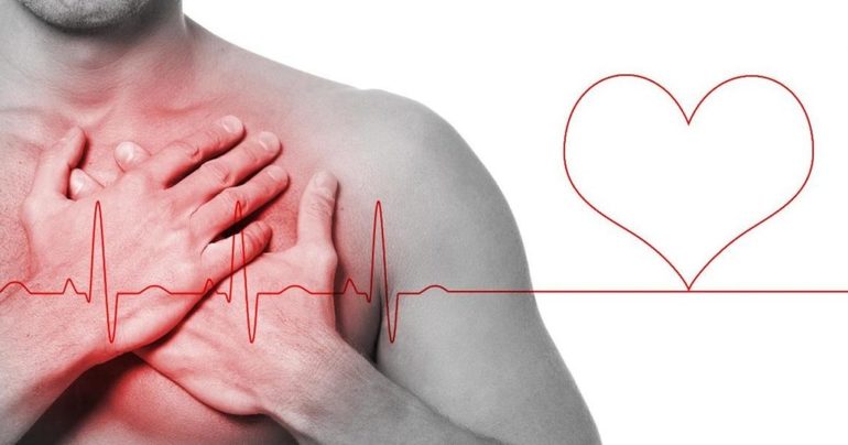 Нарушения в работе сердца,