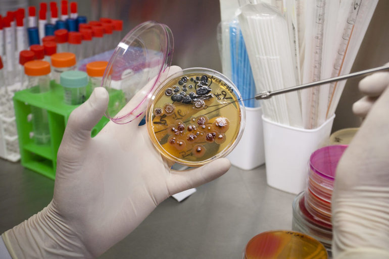 Назначают бакпосев.