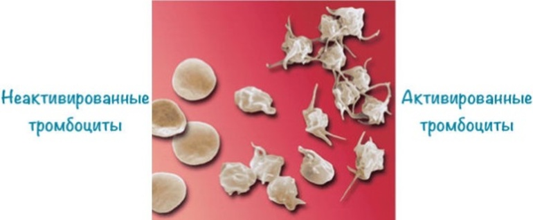 низкие тромбоциты в крови