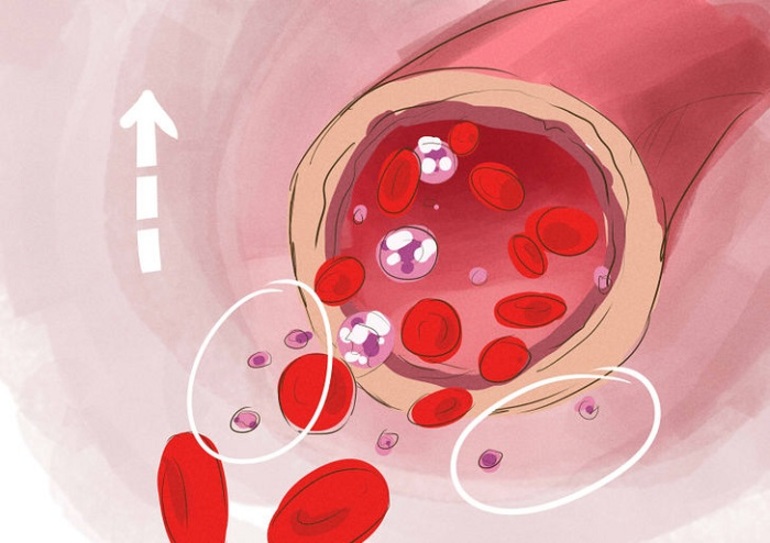 низкий уровень тромбоцитов в крови причины