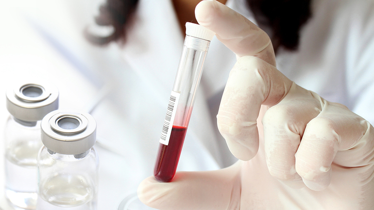 Норма АсАТ в крови у женщин