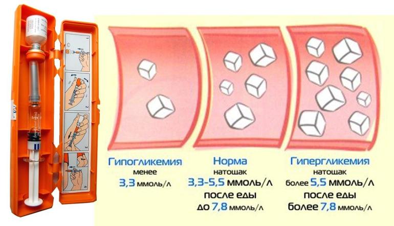 Норма сахара в крови
